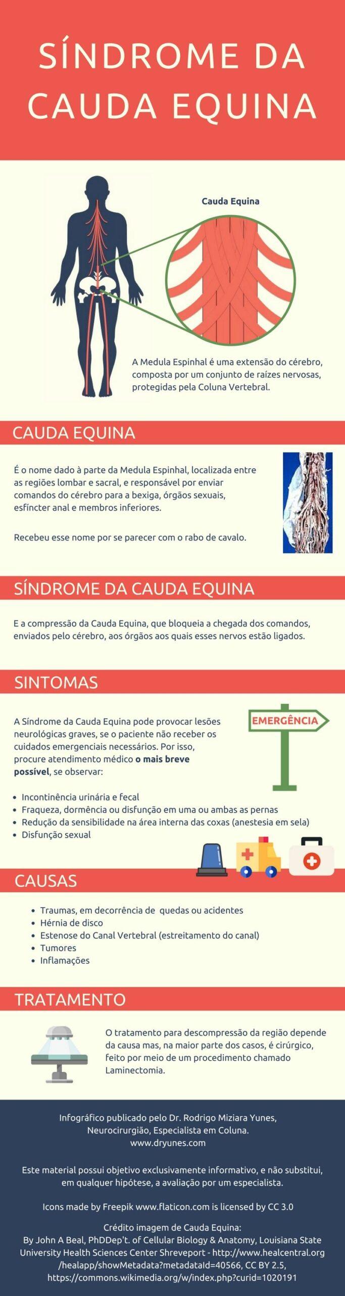 sindrome da cauda equina infografico sindrome da cauda equina infografico